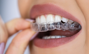 orthodontic treatment